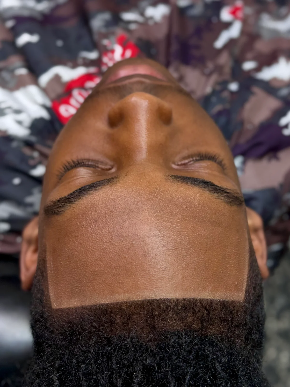 Squared hairline detail