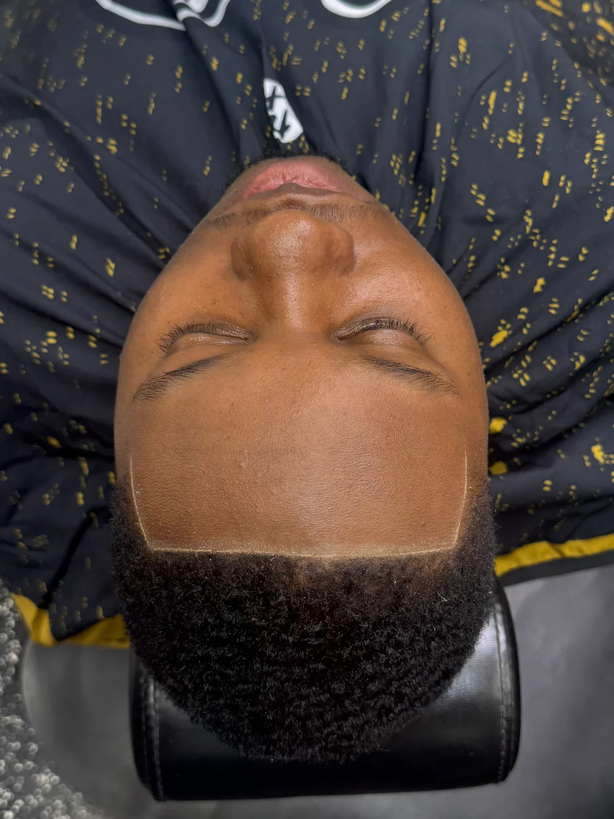 Precision hairline
